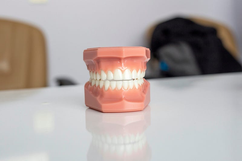 Dental model representing teeth and bite.