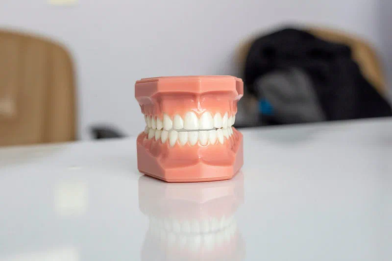 Dental model representing teeth and bite.